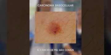 Hugh Jackman revela una impactante advertencia sobre su salud que no te puedes perder