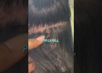 Descubre la verdad sobre los sueros para el cuero cabelludo y su impacto en la caída del cabello en la mediana edad ¡No te lo pierdas! Primer plano vertical del cuero cabelludo con la raya del pelo, mechones separados por un dedo y texto superpuesto.